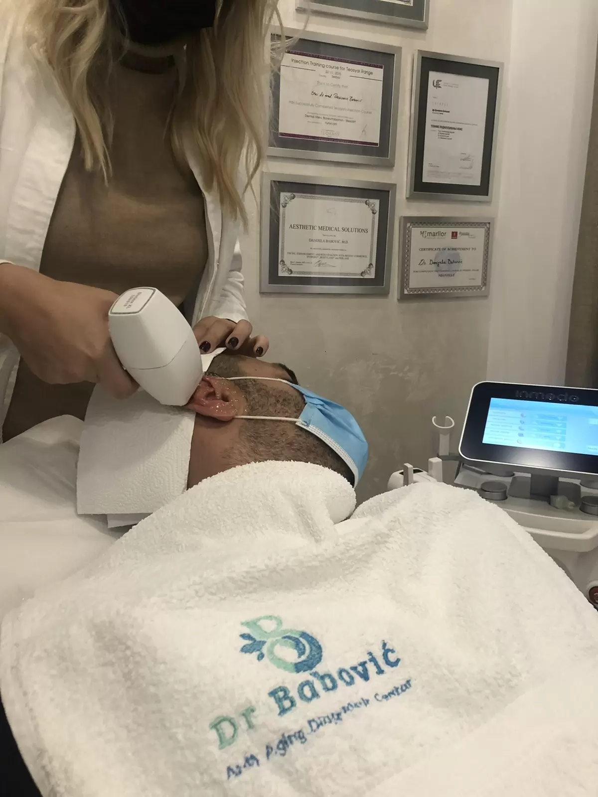 Maljavost tretman kože laserom - uklanjanje dlaka